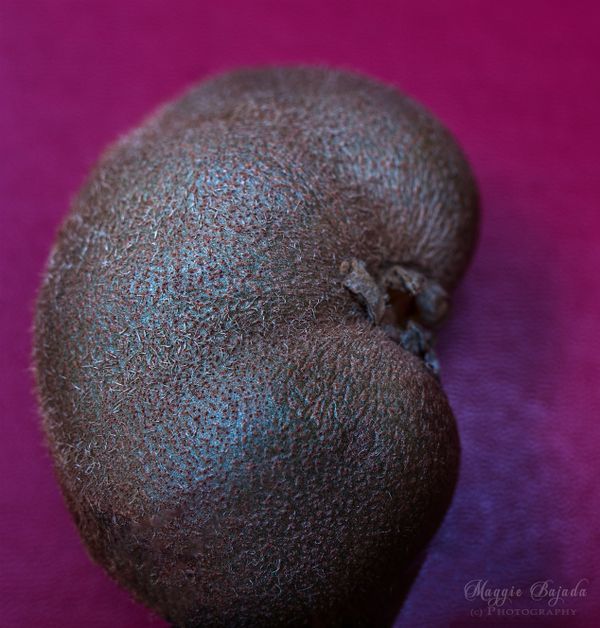 Kiwi shaped Fruit or Human Embro ?