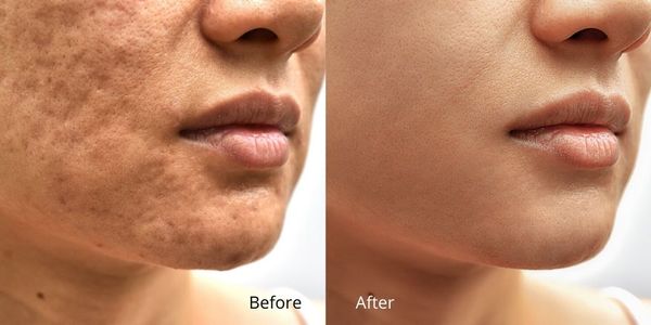 Skin Retouching Service from Tradexcel Graphics